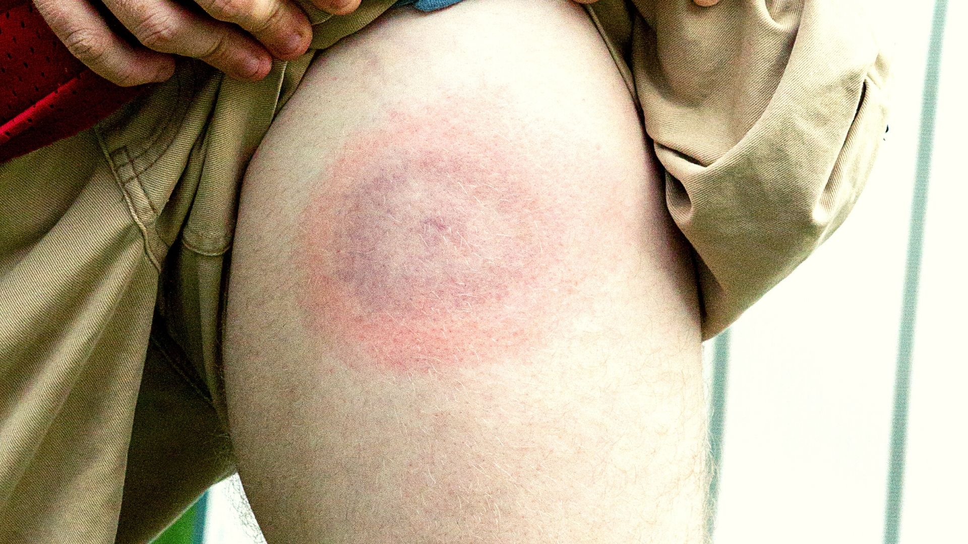 Teken en impact op sport en bewegen | Sportzorg